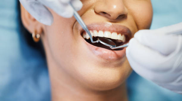 Best Emergency Treatment for Dental Infections or Abscesses in Essexville, MI